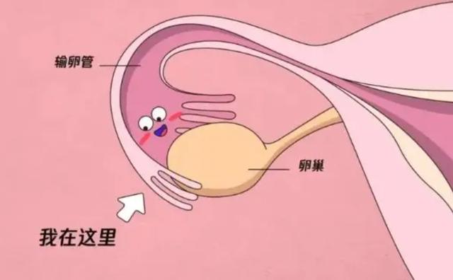 试管婴儿