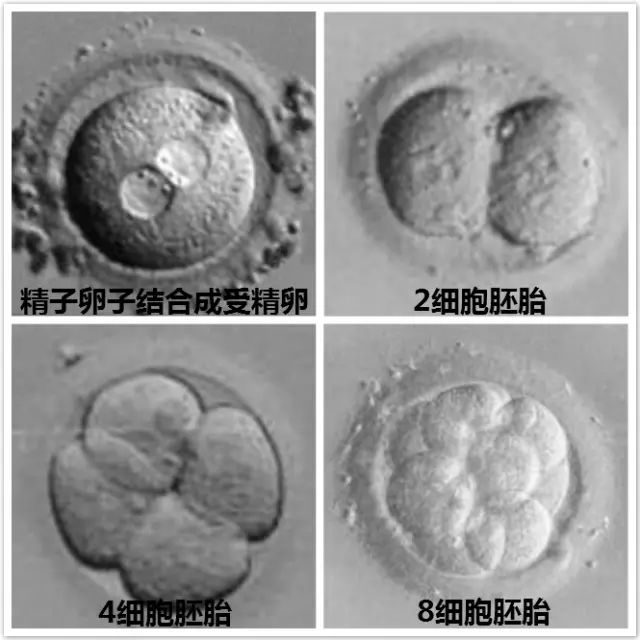 试管婴儿费用