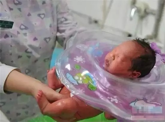 卵子冷冻