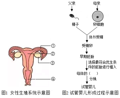 试管婴儿