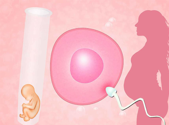 单身女性试管婴儿